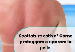 Scottature estive? Come proteggere e riparare la pelle.